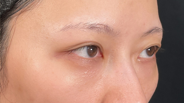 手术前的状态 其一