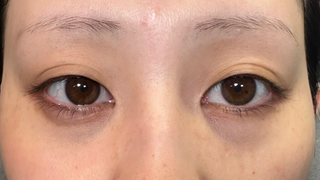 手术前的状态 其一