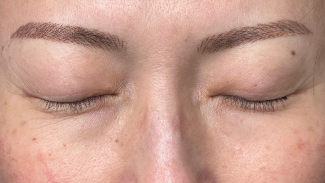 手术前的状态 其一