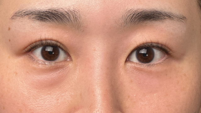 手术前的状态 其一