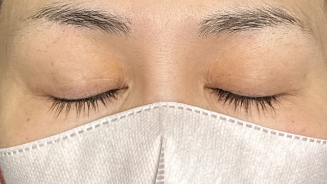 Preoperative Condition Part 1