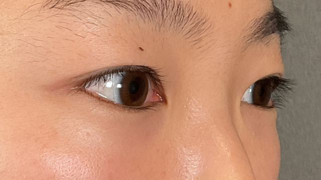 手术前的状态 其一