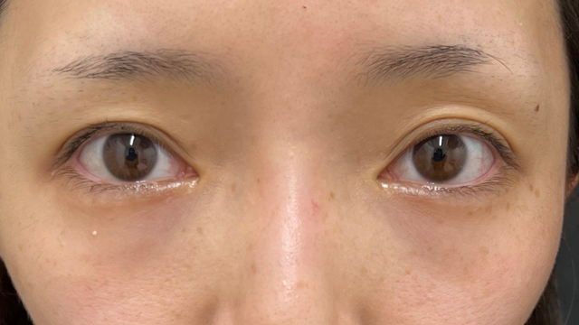 Preoperative Condition Part 1