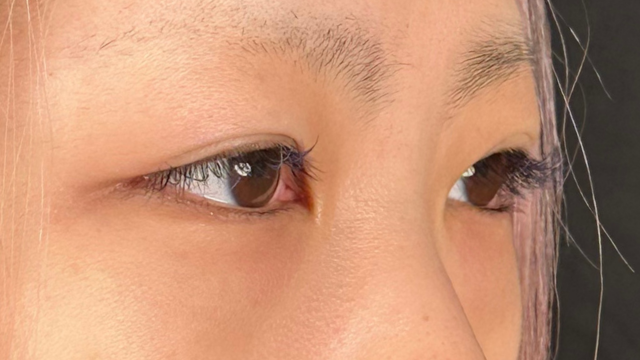 手术前的状态 其一