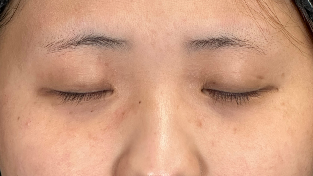 Preoperative Condition Part 1