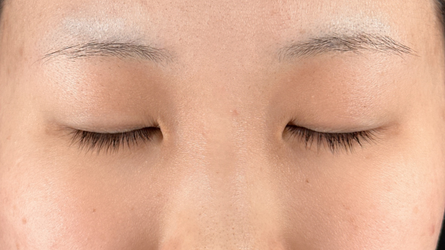 手术前的状态 其一