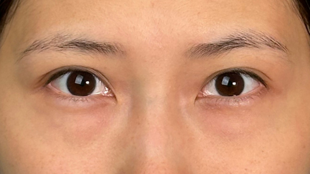 Preoperative Condition Part 1