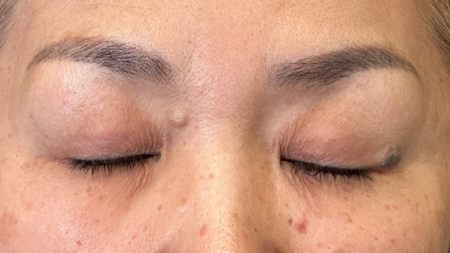 Preoperative Condition Part 1