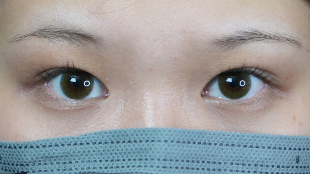 Preoperative Condition Part 1