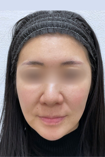 手术前的状态 其一