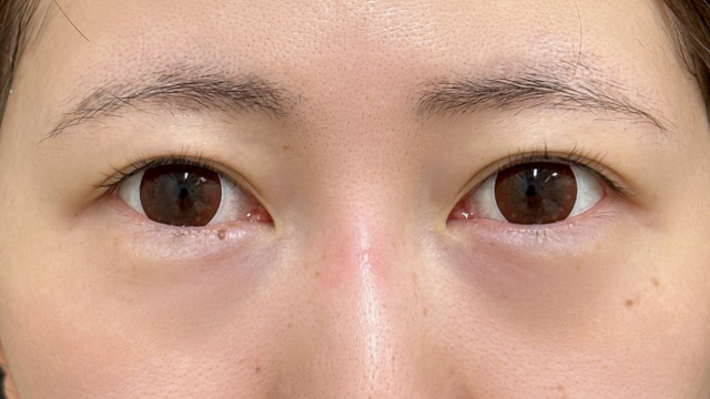 手术前的状态 其一