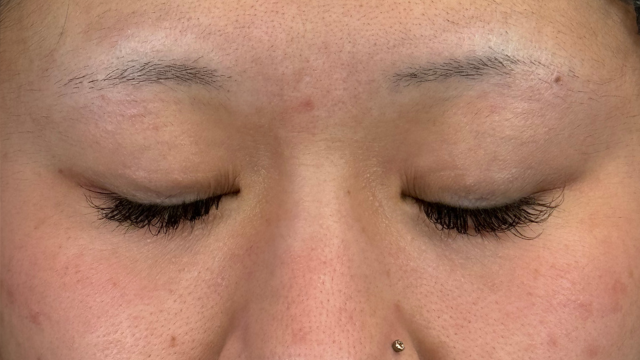 手术前的状态 其一