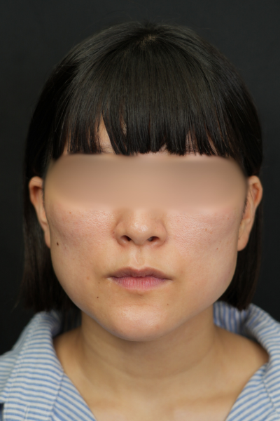 手术前的状态 其一