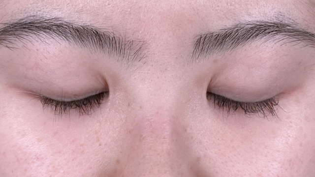 Preoperative Condition Part 1