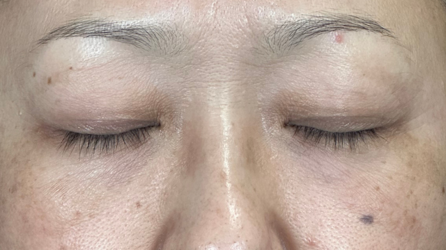 Preoperative Condition Part 1