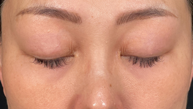 Preoperative Condition Part 1