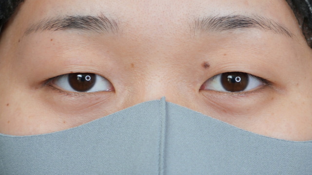 手术前的状态 其一