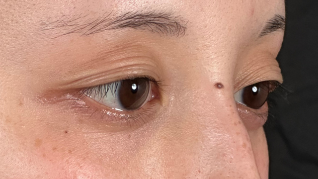 手术前的状态 其一