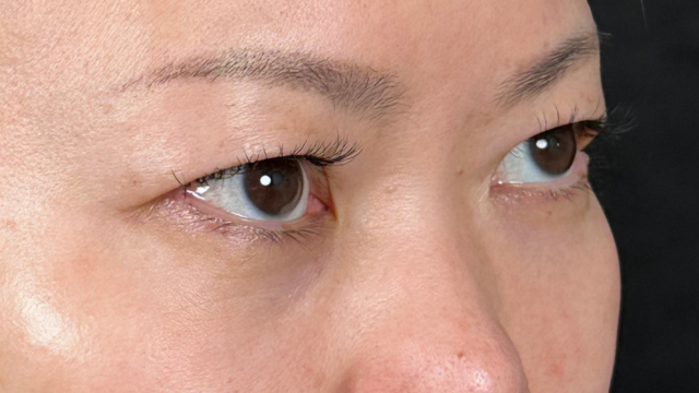 Preoperative Condition Part 1