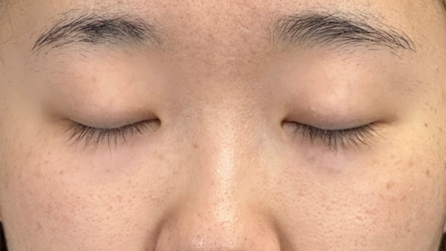 Preoperative Condition Part 1