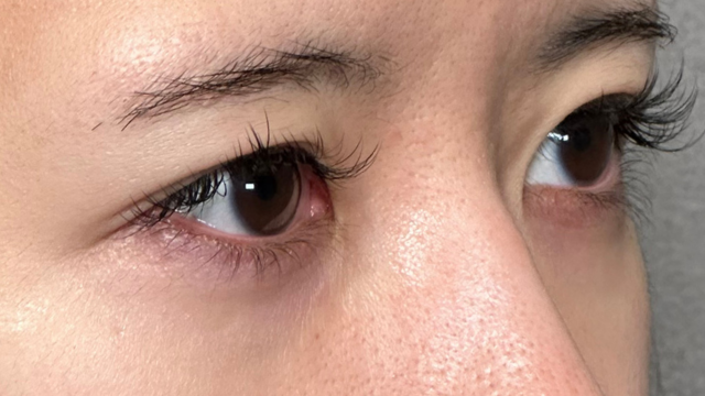 手术前的状态 其一