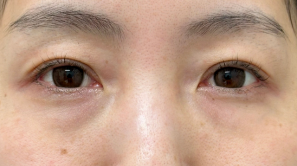 Preoperative Condition Part 1