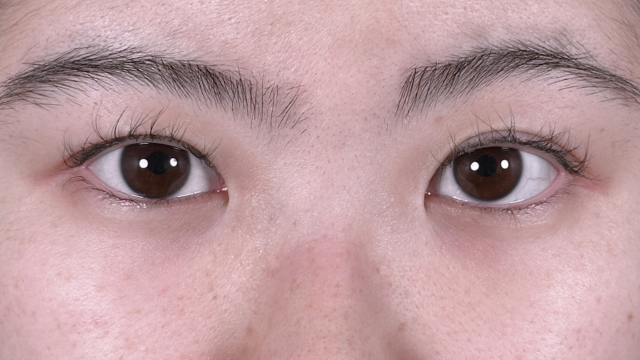 Preoperative Condition Part 1