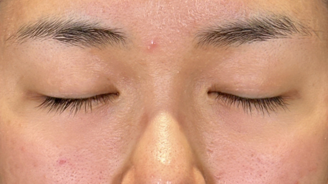 Preoperative Condition Part 1