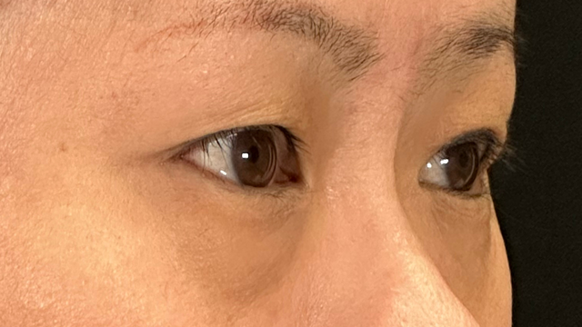 Preoperative Condition Part 1