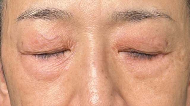 手术前的状态 其一