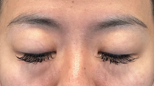 Preoperative Condition Part 1