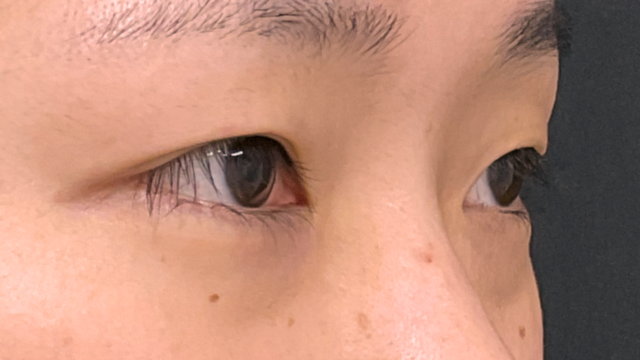 手术前的状态 其一