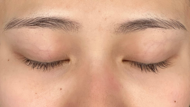 手术前的状态 其一