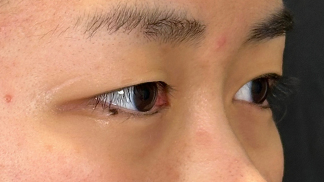 Preoperative Condition Part 1