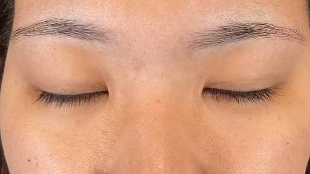 手术前的状态 其一