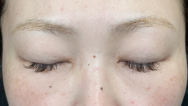 手术前的状态 其一