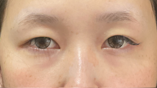 手术前的状态 其一