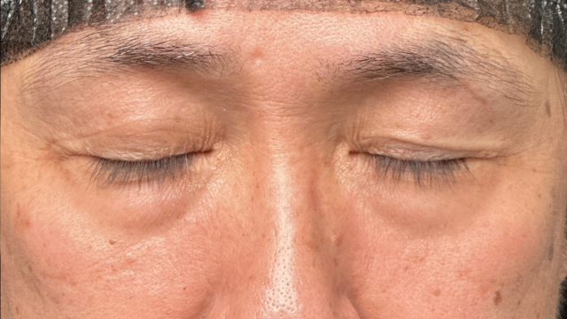 手术前的状态 其一