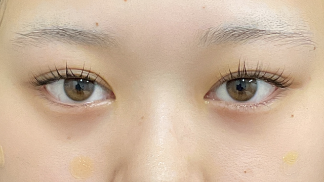 Preoperative Condition Part 1