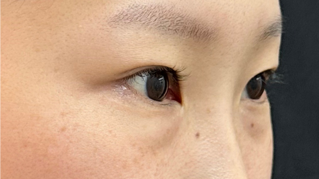 手术前的状态 其一