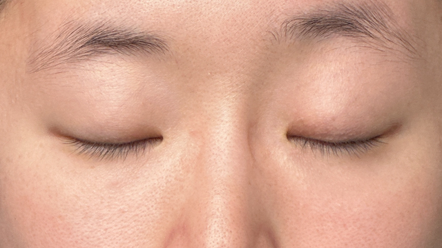 Preoperative Condition Part 1