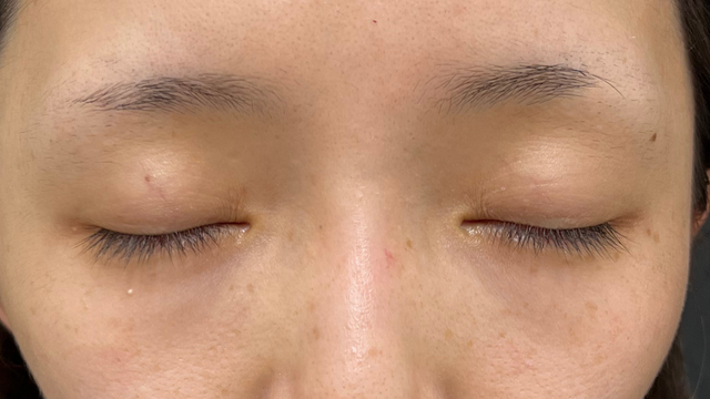 Preoperative Condition Part 1