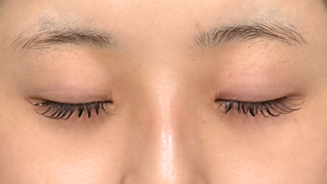 Preoperative Condition Part 1