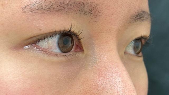 手术前的状态 其一