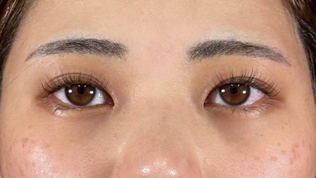 Preoperative Condition Part 1