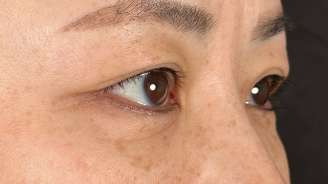 手术前的状态 其一