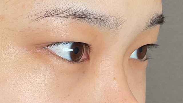 手术前的状态 其一