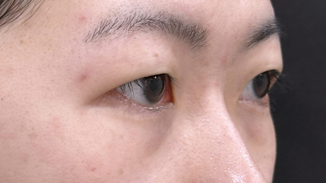 Preoperative Condition Part 1