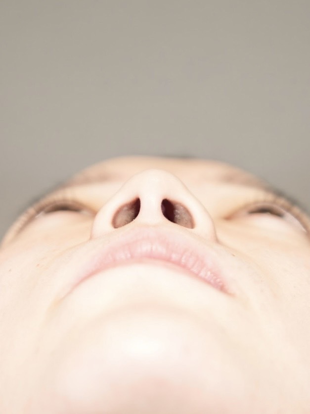 手術前の状態 その1