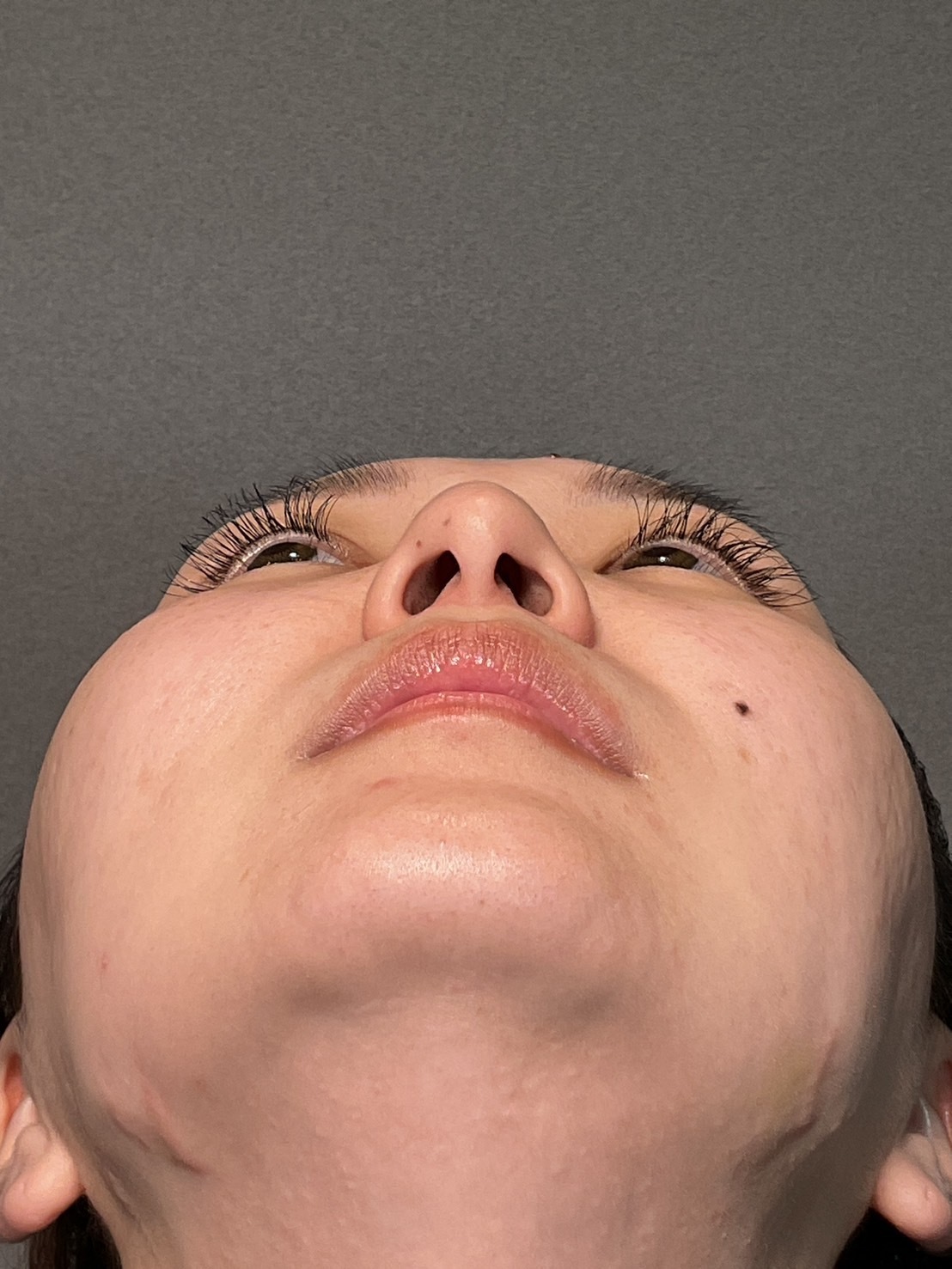 手術前の状態 その1